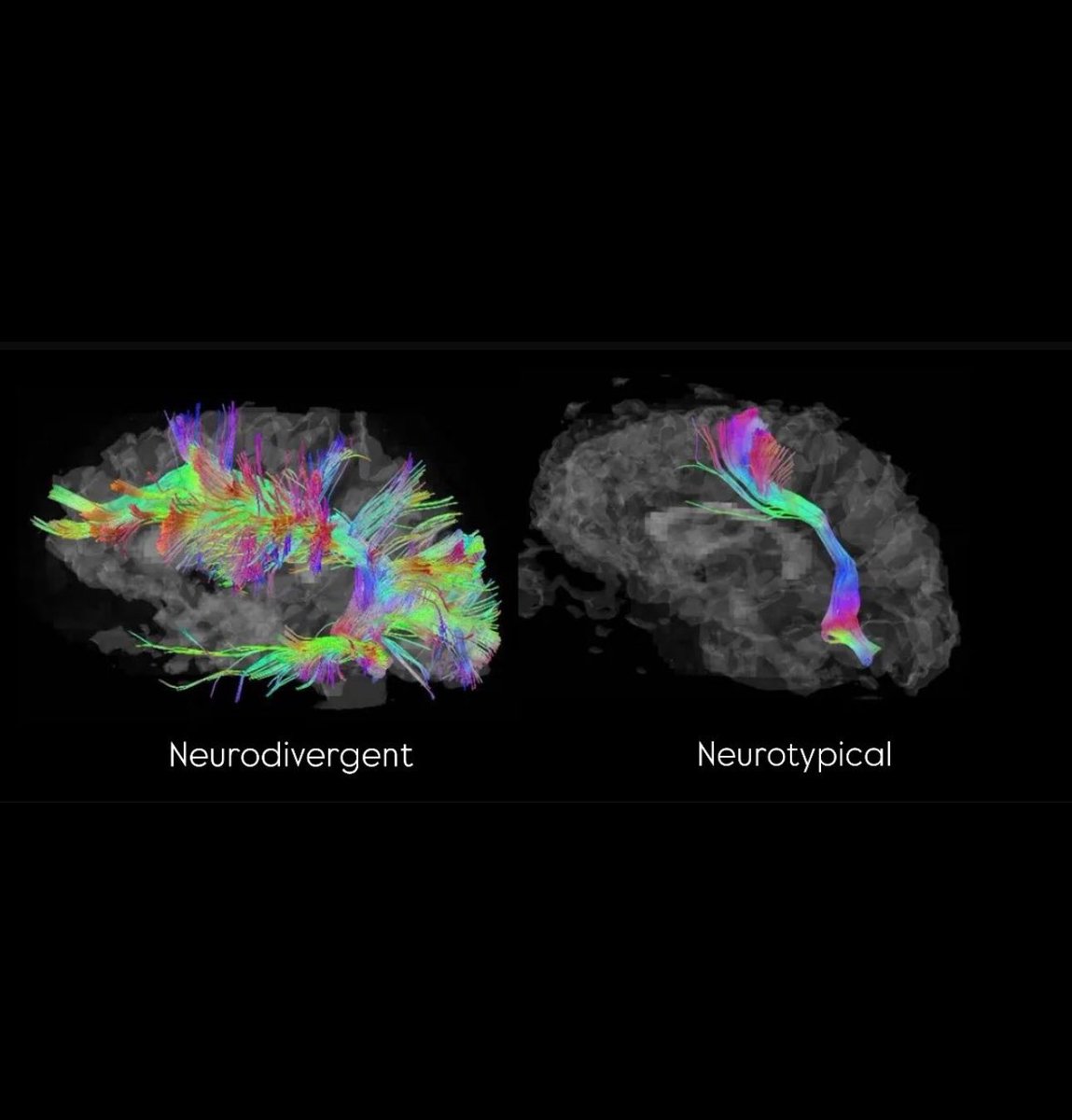 ilana_brac's tweet photo. They: “Oh my, you are so intense”

Me: “Perhaps you are trying to find an excuse of you being boring and tasteless”

Also me (as neurodivergent): https://t.co/oXWfLRPvyT