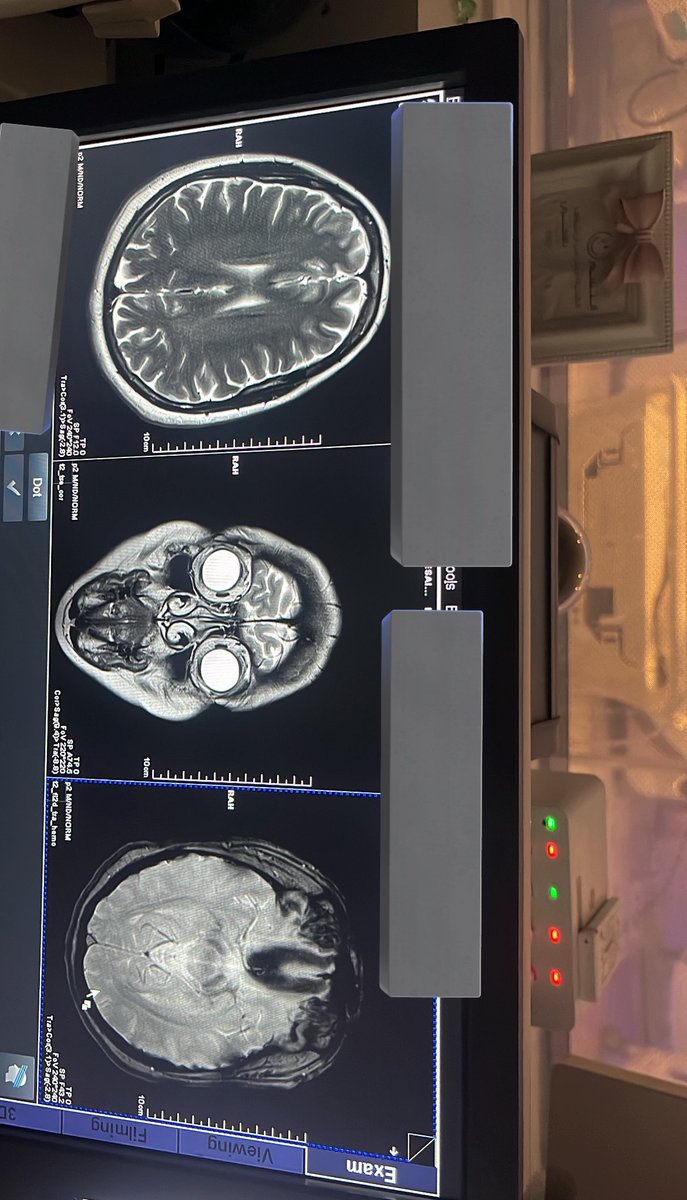 iii47x_'s tweet photo. 22-june 
بداية سنه الامتياز | 
MRI the first Rotation☢️❣️ https://t.co/CvrtxJrcaF