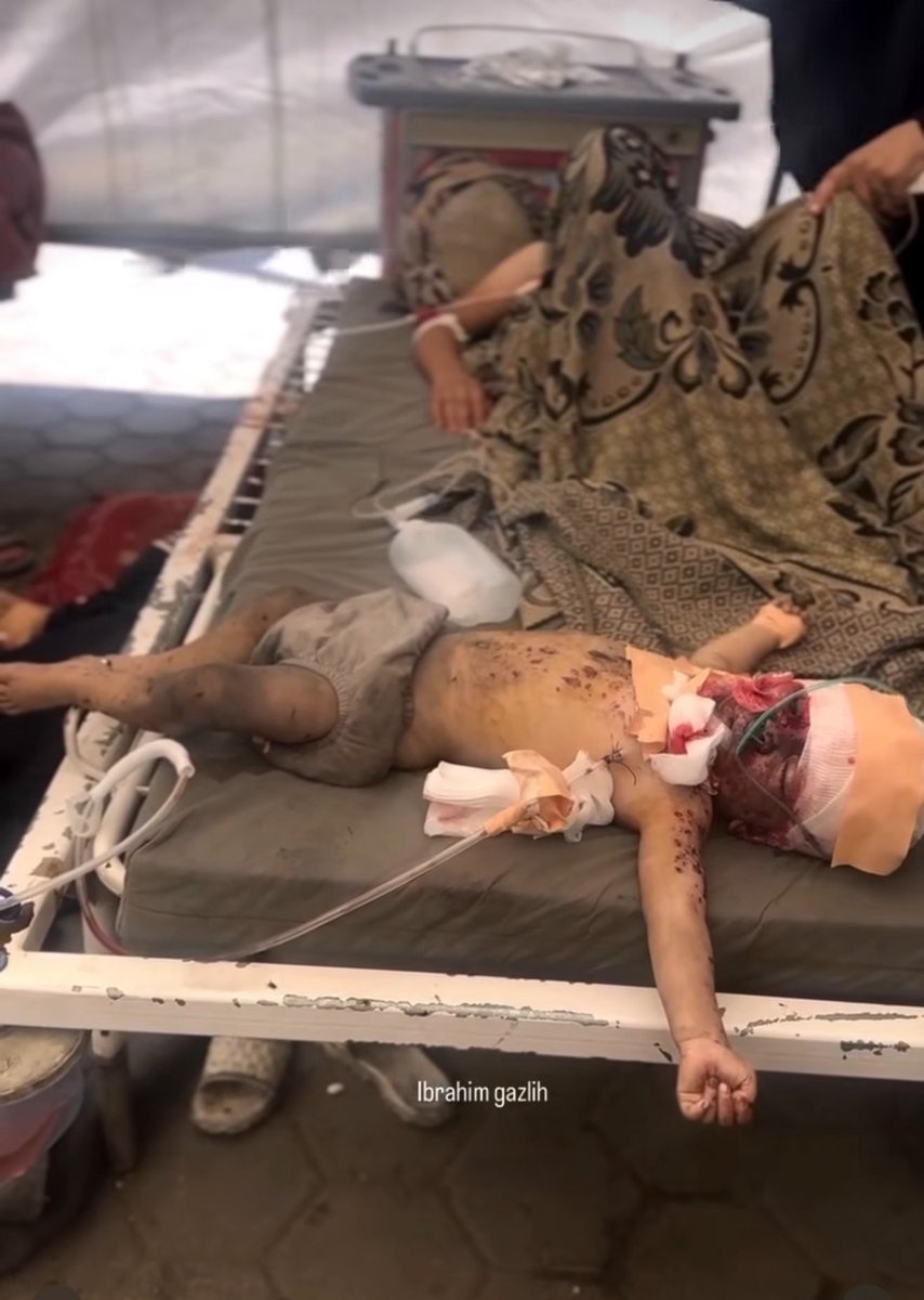 MosabAbuToha's tweet photo. A baby who survived and is currently in a field hospital. This is agonizing to look at. https://t.co/Gw2CmExs5q