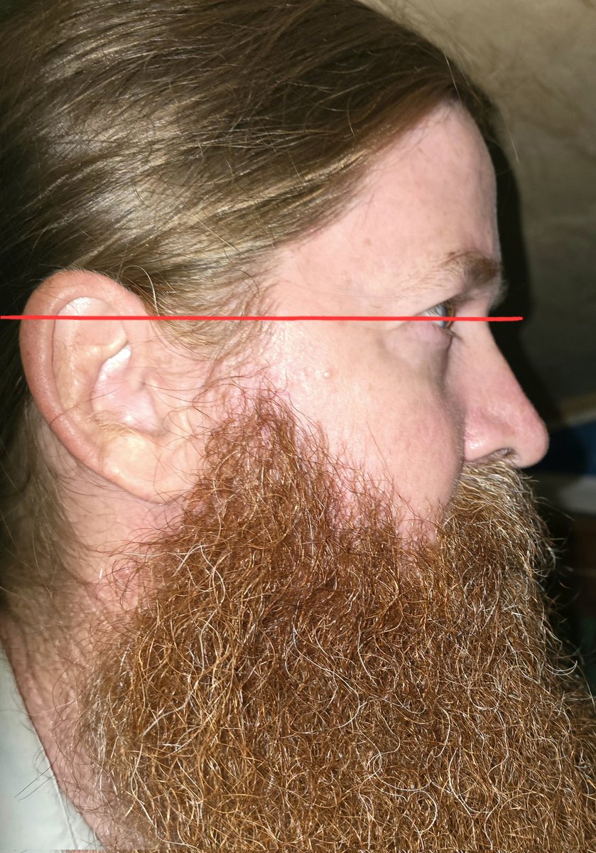 For the Dustin Nemos' and others resorting to "jew jacketing" me here is the side profile u have been incessantly demanding:
Low forehead, no defined brow ridge, straight proportionate nose, ear line above the eyes. 
Now enough with the copes already..