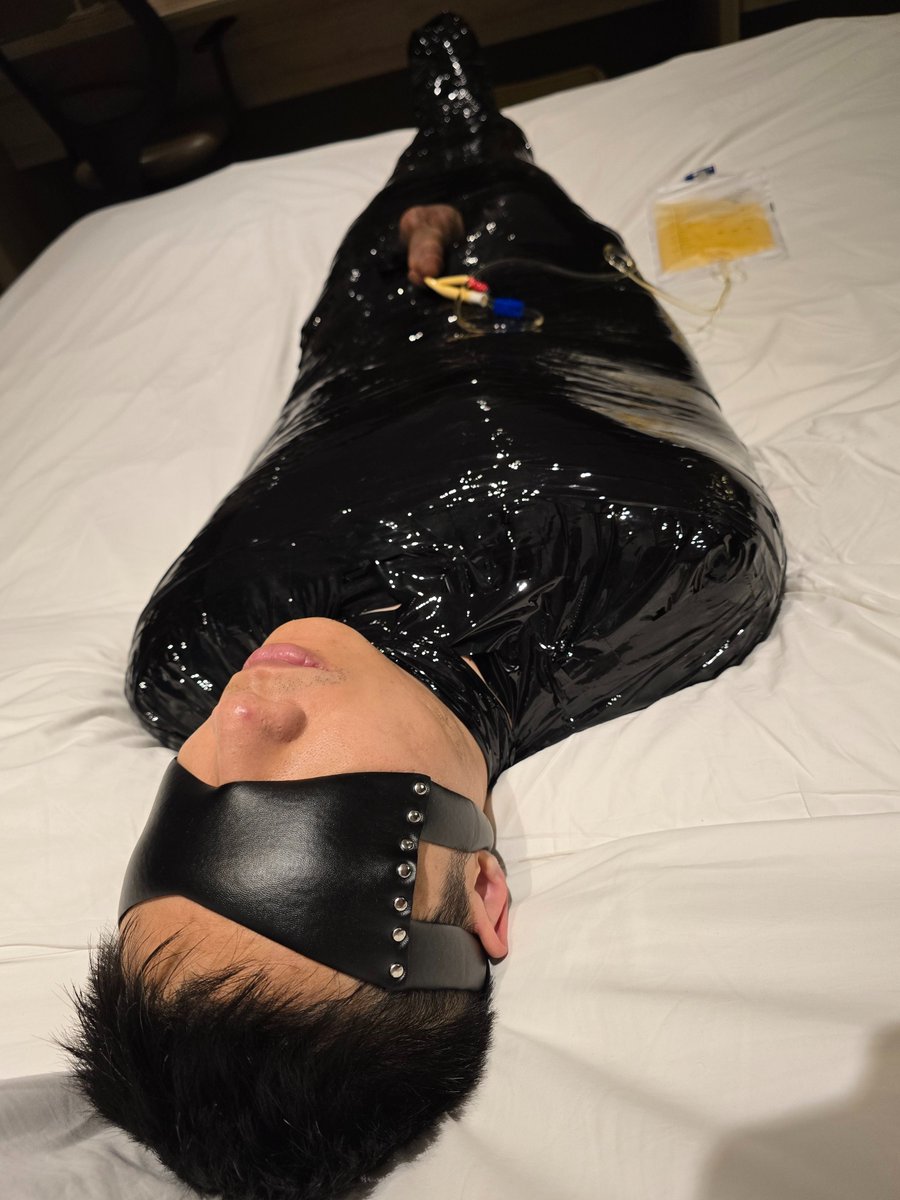 #木乃伊 #导尿
刚绑完很舒服，甚至睡了两小时
然后被汗泡醒怎么都挣不开，第二天早上放出来人已经泡发了🥲
导尿有种憋不住的感觉，就好像永远在尿
拔管的感觉像射精但是巨痛、巨灼烧
后面3天小便巨痛，咬着毛巾和纸巾才敢尿