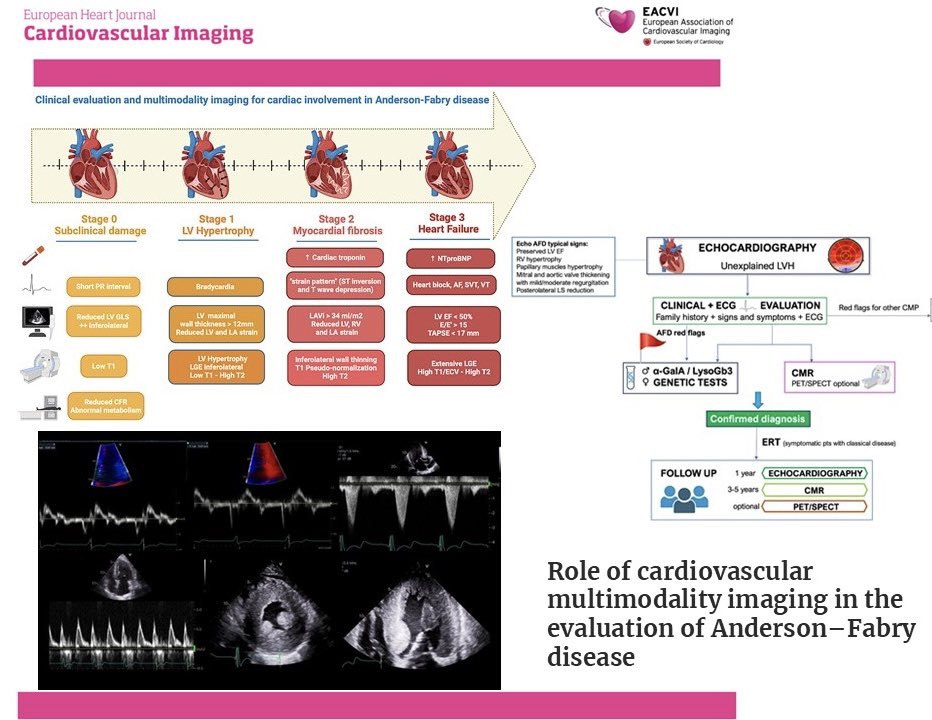 EHJCVIEiC's tweet image. #EHJCVI Most read ➡️ This consensus statement aims to provide practical advice for all clinicians regarding the use of #multimodality #imaging to simplify the diagnostic evaluation, prognostic stratification, and management of cardiac involvement in AFD ➡️ academic.oup.com/ehjcimaging/ar…