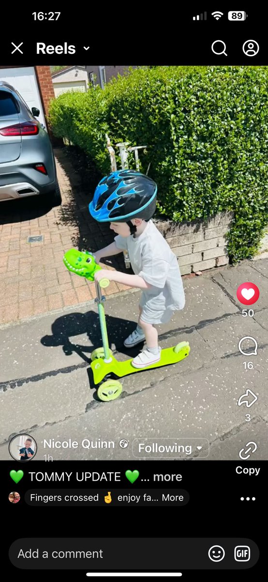 WeeTommysJrny's tweet image. facebook.com/share/v/1ASm8x…
A wee Tommy Quinn update 

This wee fellas got a take it head on attitude there’s no keeping him down 

If anyone can assist with any fundraising events please get in touch 

@Wee_Oscar 
@ACSOMPOD 
@ETimsNet 
@celticexchange1 
@kierantierney1 
@SKC_UK