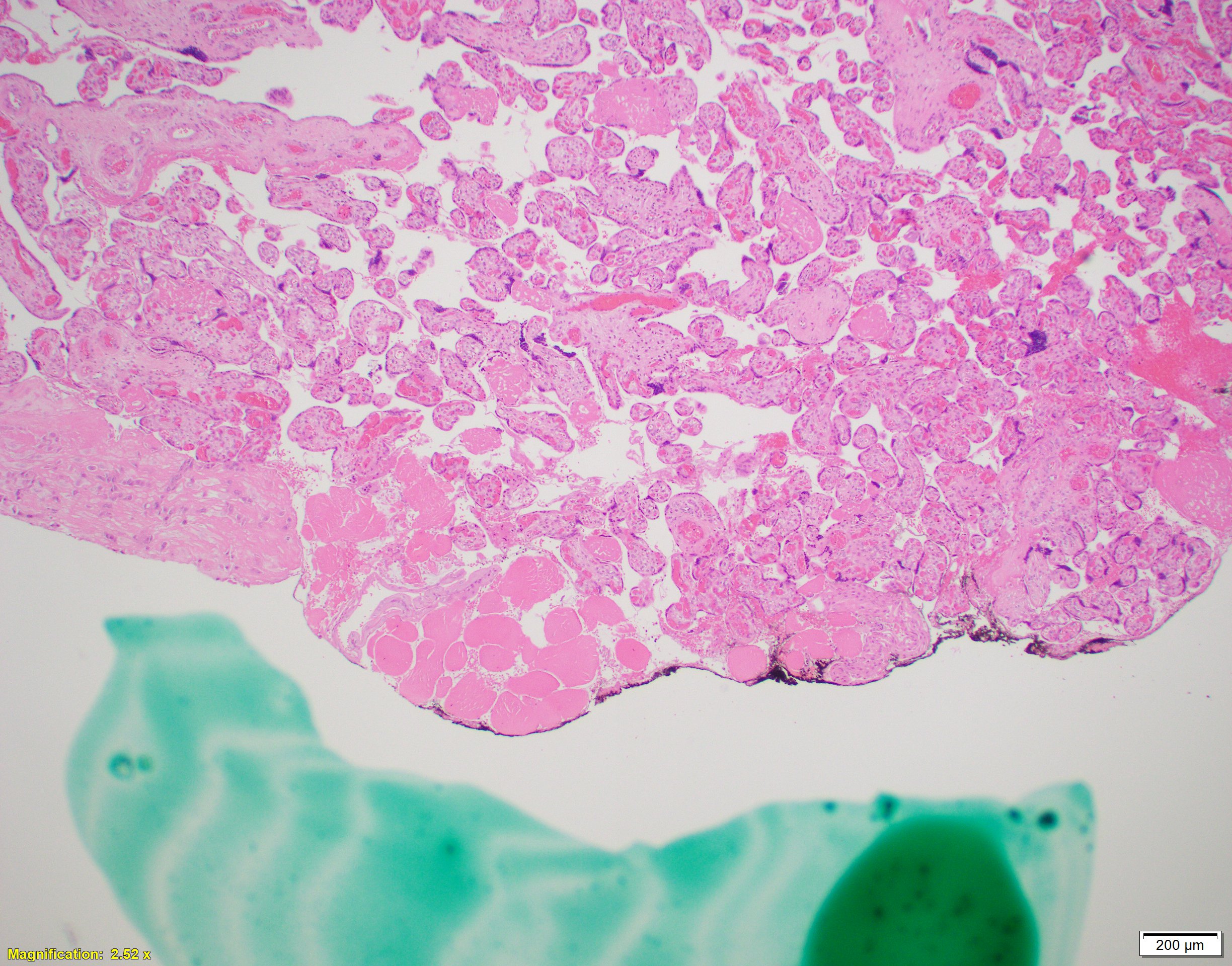 placenta - Search / X