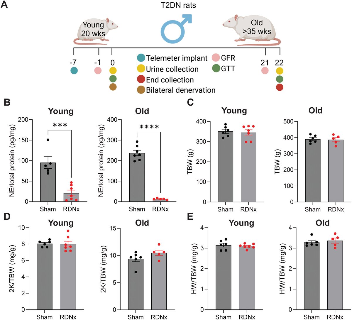 staruschenko's tweet image. Effect of Renal Denervation on Early and Late Stages of Diabetic Nephropathy by @biyang_xu @Banek_Lab and colleagues published @FASEBorg @FASEBPubs.  Here, we highlighted the importance of disease stage when considering RDNx. faseb.onlinelibrary.wiley.com/doi/full/10.10…