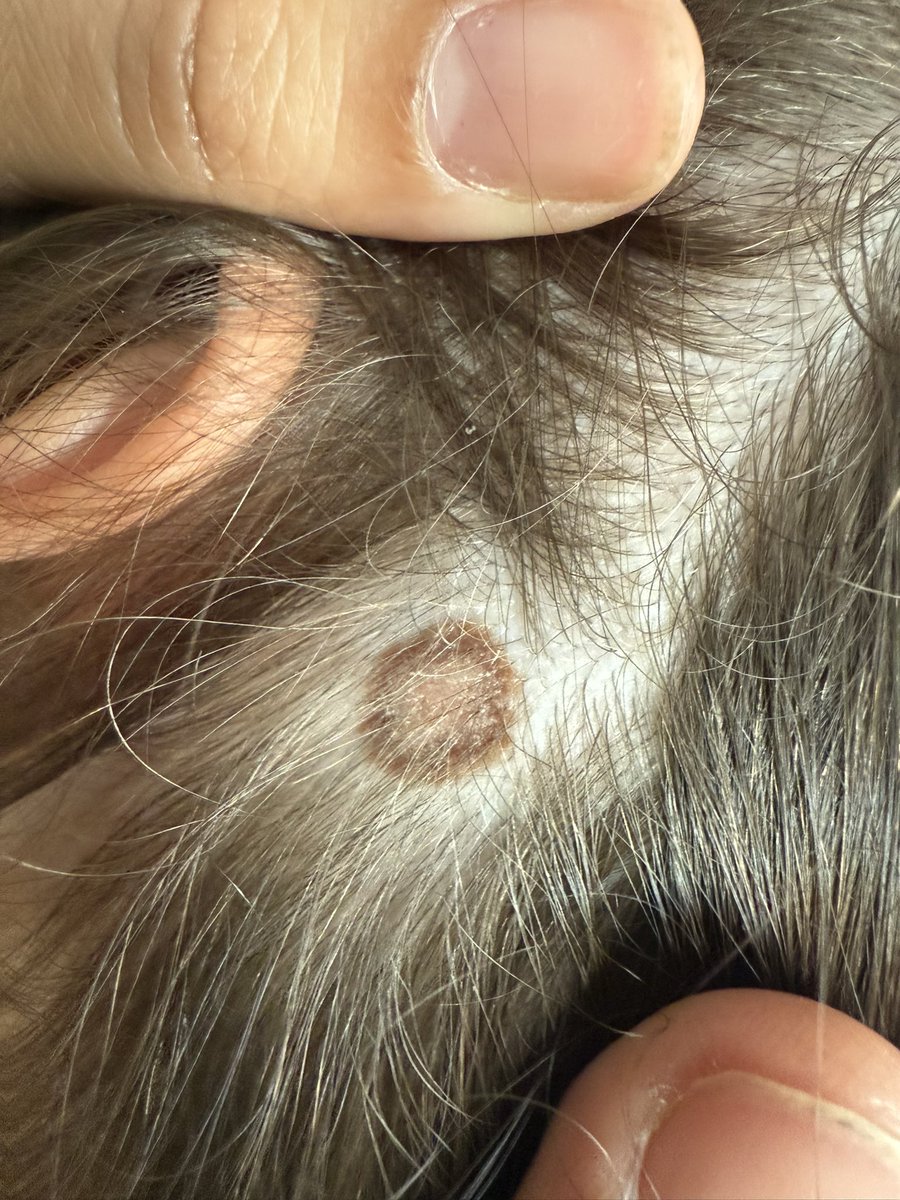 Anyone know if this is a birthmark?