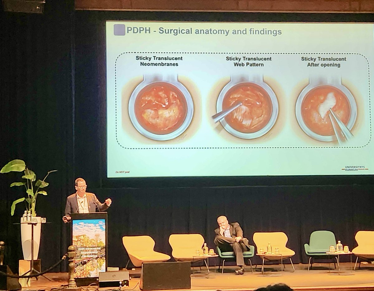Spinal CSF Leak Foundation (@spinalcsfleak) on Twitter photo And the final talk of this section, Dr. <a href="/JrgenBeck/">Jürgen Beck</a> discussed surgical treatment of PDPH, including some of the anatomical findings he's seen when performing surgeries on patients with PDPH: And the final talk of this section, Dr. <a href="/JrgenBeck/">Jürgen Beck</a> discussed surgical treatment of PDPH, including some of the anatomical findings he's seen when performing surgeries on patients with PDPH: