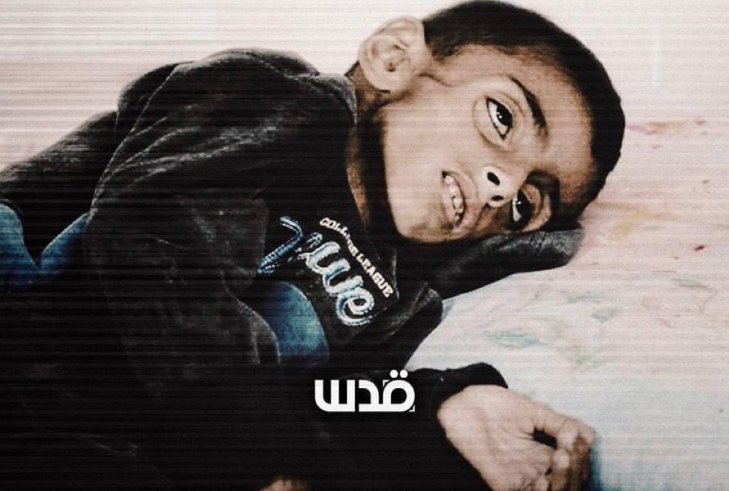 ShaykhSulaiman's tweet photo. This is what they are doing to kids in Gaza. 

Mainstream media won’t show you this. https://t.co/mWImi1ZZsy