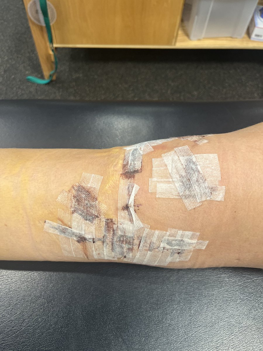 MakGolden1's tweet photo. 1 year ago today my “career ending” injury happened. I’m so thankful for my family, friends, physical therapist, high school coach and the UNA coaches who believed in me and supported me through it. ROAR LIONS!!!💜🦁 #GodIsGood @UNAwbb @BreTaylor_20 @coachchrisSH @avonhaefen https://t.co/s9wBtaU9R5