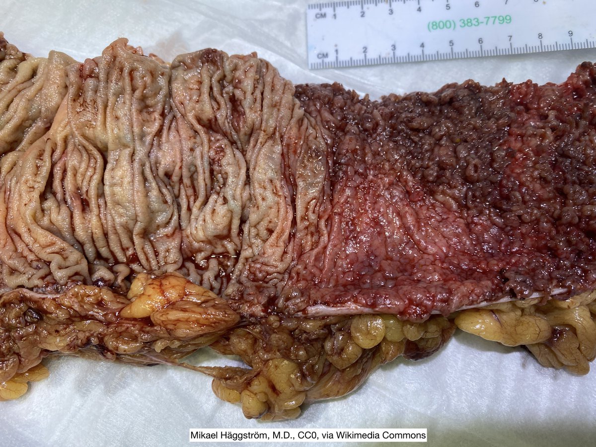 Jay "Thymocyte" Hwang tweet media