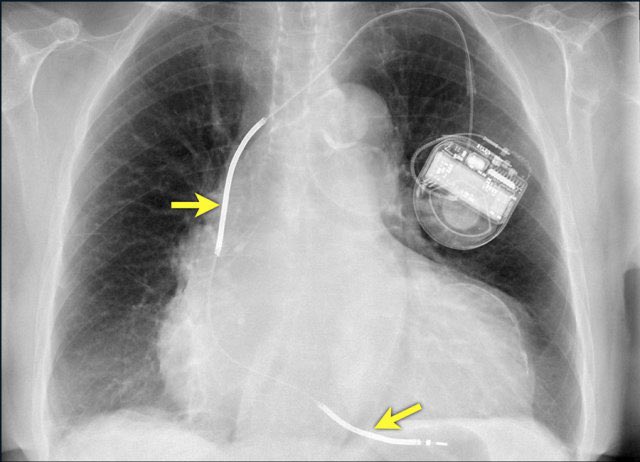 ١) خطوة واحد تعرفون اسم الجهاز ؟!!

٢) والرهيب يقدر يخمن كم ال ejection fraction بدون ما يطالع ملف المريض ؟؟