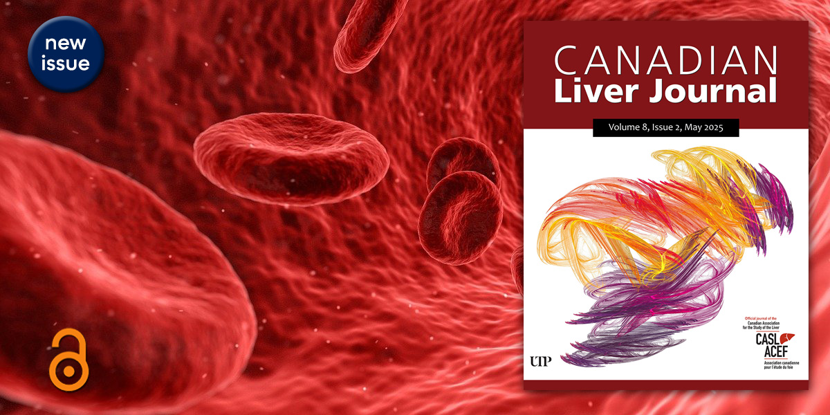 UTP Journals (@utpjournals) on Twitter photo Cirrhosiscare.ca is an expert consensus-based online palliative care resource for #HealthCare providers. Discover how this platform aims to improve symptom burden for #cirrhosis patients in the CanLivJ 8.2: bit.ly/CanLivJ82f
<a href="/UAlberta/">University of Alberta</a> <a href="/CirrhosisCareAB/">Cirrhosis Care Alberta</a> <a href="/CASLupdates/">CASL</a> Cirrhosiscare.ca is an expert consensus-based online palliative care resource for #HealthCare providers. Discover how this platform aims to improve symptom burden for #cirrhosis patients in the CanLivJ 8.2: bit.ly/CanLivJ82f
<a href="/UAlberta/">University of Alberta</a> <a href="/CirrhosisCareAB/">Cirrhosis Care Alberta</a> <a href="/CASLupdates/">CASL</a>