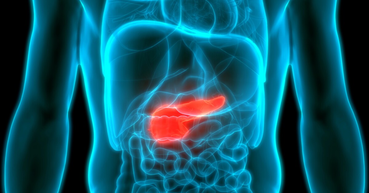 DanielBurrus's tweet photo. Breakthrough in pancreatic cancer treatment: A new vaccine eradicates cancer cells in preclinical trials. A promising step forward in the fight against one of the deadliest cancers. #CancerResearch #PancreaticCancer #HardTrends
https://t.co/blTSfxJ3Zg https://t.co/7bC7h0ISFW