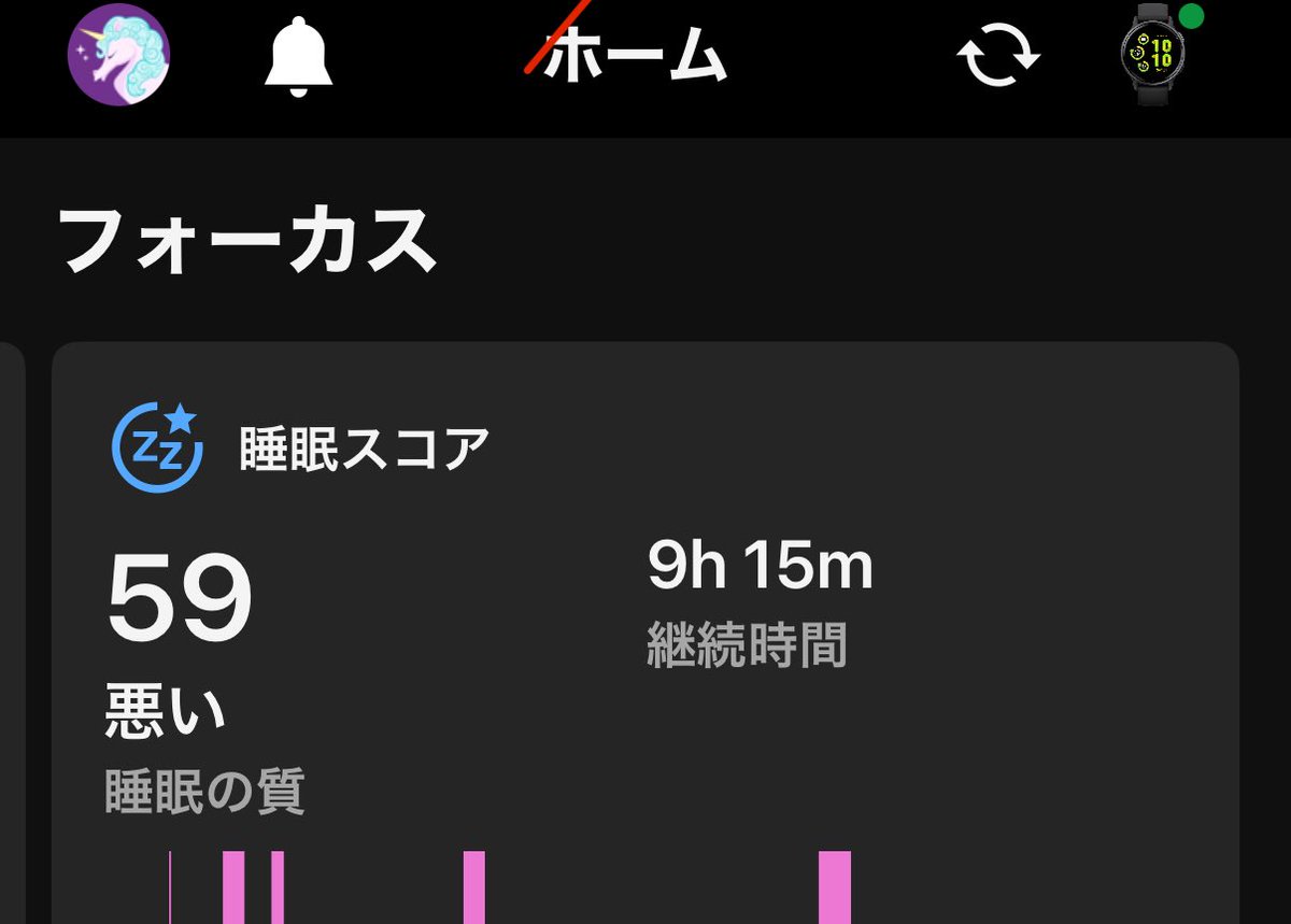 yasmanabe's tweet image. 9時間睡眠を達成したのにGarminはまったく評価してくれない。毎朝、昨夜の自分を否定してくるスマートウォッチとの関係を見直したい。
「ケアとは、現在を未来の「手段」にしない(略)現在を目的とする思想であり行為なのである」-白石正明『ケアと編集』