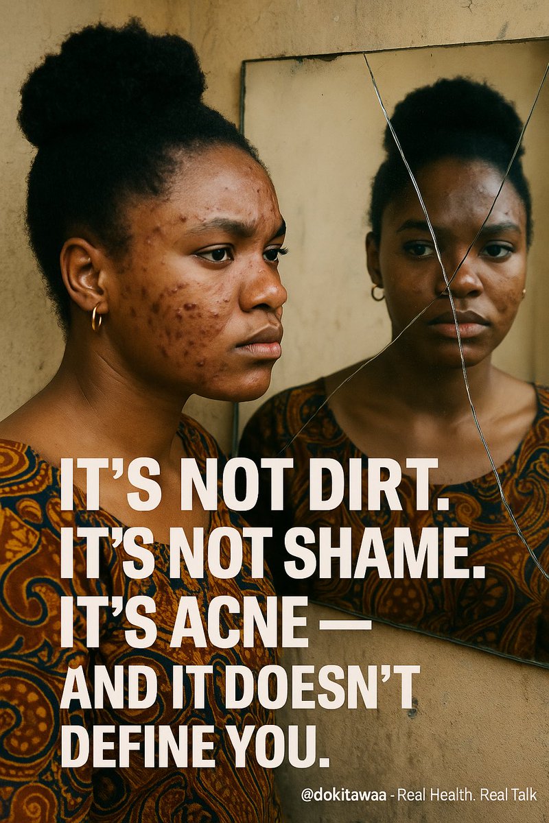 The face is the first thing people see. But when it’s covered in acne, you just want to hide.

You’ve tried everything — black soap, creams, even prayers.

Sometimes it clears. Then comes back.
Other times, it never leaves.

Some gave up.
This thread — compiled with a renowned