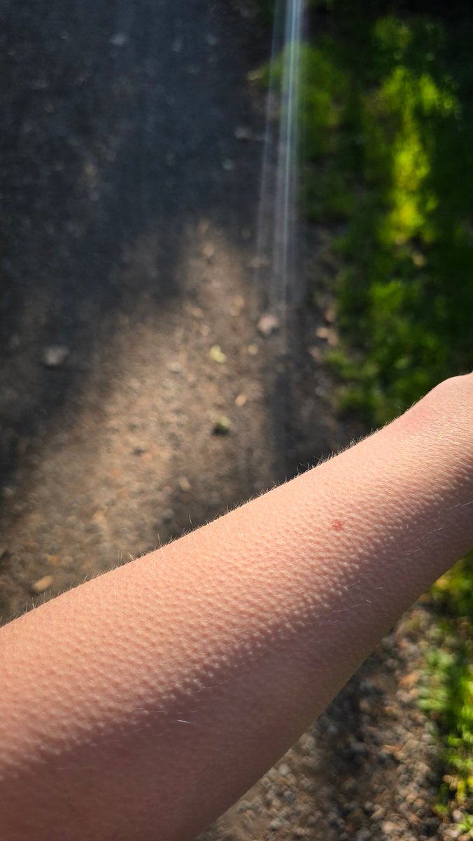 Frieren im Sommer übel geil oder?