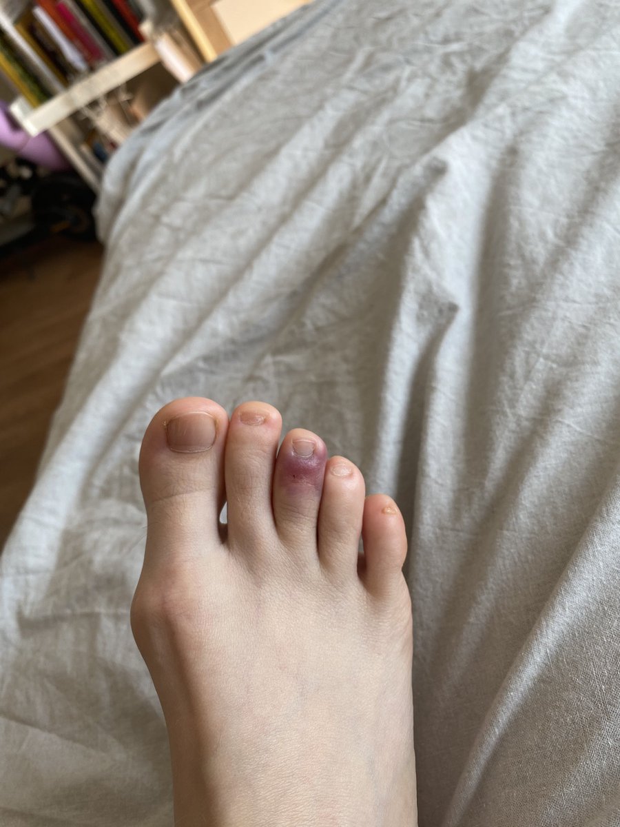 Павербанк впав на ногу🙄