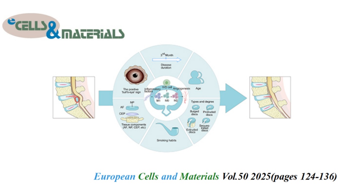 👏Check eCM latest articles: An analysis of predictive factors and potential mechanisms underlying lumbar disc herniation resorption

ecmjournal.org/papers/vol050/…

#LumbarDiscHerniation #Resorption #Mechanisms #PredictiveFactors #Macrophages
