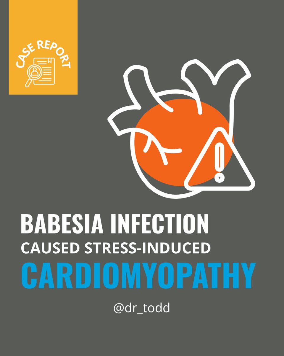 A newly published case report describes a rare and life-threatening complication of #babesiosis—Takotsubo (stress-induced) #cardiomyopathy.

A 74-year-old woman developed severe babesiosis following a tick bite. Initial #tickborneinfection testing was negative. Her condition