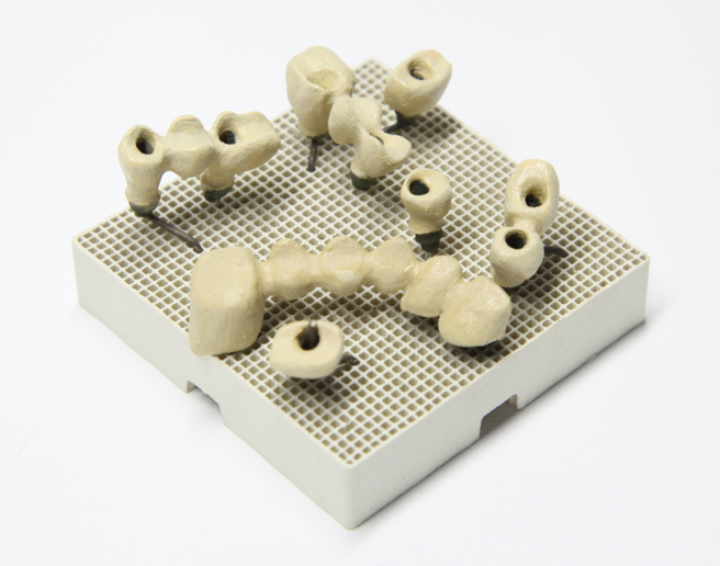 TheLabProtesis's tweet image. Si quieres buenos resultados, los procedimientos tienen que ser perfectos, impolutos... Coronas metal-cerámica en proceso.
¿Quieres contratar nuestros servicios? No dudes en llamar al 913-230-700, o escríbenos!