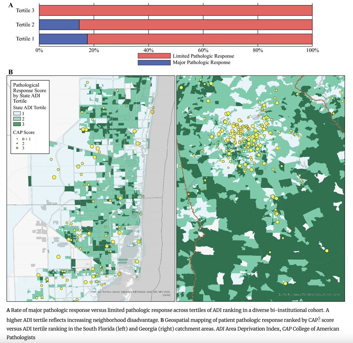 Annals of Surgical Oncology (@annsurgoncol) on Twitter photo June Issue: #NeighborhoodDisadvantage is Associated with Worse Pathologic Response in #PancreaticCancer <a href="/NbmerchantMD/">Nipun Merchant</a> <a href="/KobetzErin/">Erin Kobetz</a> <a href="/caitlinahester/">Caitlin Hester</a> <a href="/skmaithel/">Shishir K. Maithel</a>
rdcu.be/etM2l
<a href="/DenboJw/">Jason W Denbo</a>
<a href="/SyedAAhmad5/">Syed A. Ahmad</a> June Issue: #NeighborhoodDisadvantage is Associated with Worse Pathologic Response in #PancreaticCancer <a href="/NbmerchantMD/">Nipun Merchant</a> <a href="/KobetzErin/">Erin Kobetz</a> <a href="/caitlinahester/">Caitlin Hester</a> <a href="/skmaithel/">Shishir K. Maithel</a>
rdcu.be/etM2l
<a href="/DenboJw/">Jason W Denbo</a>
<a href="/SyedAAhmad5/">Syed A. Ahmad</a>