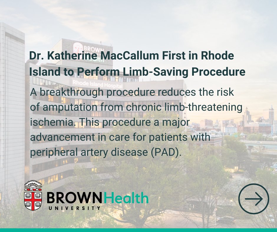 BrownUnivHealth's tweet image. Dr. Katherine P. MacCallum, a vascular surgeon with Brown Surgical Associates and Brown University Health, has become the first physician in Rhode Island to perform the LimFlow® TADV (Transcatheter Arterialization of the Deep Veins) procedure. apnews.com/press-release/…
