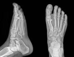 For you foot fetish people.