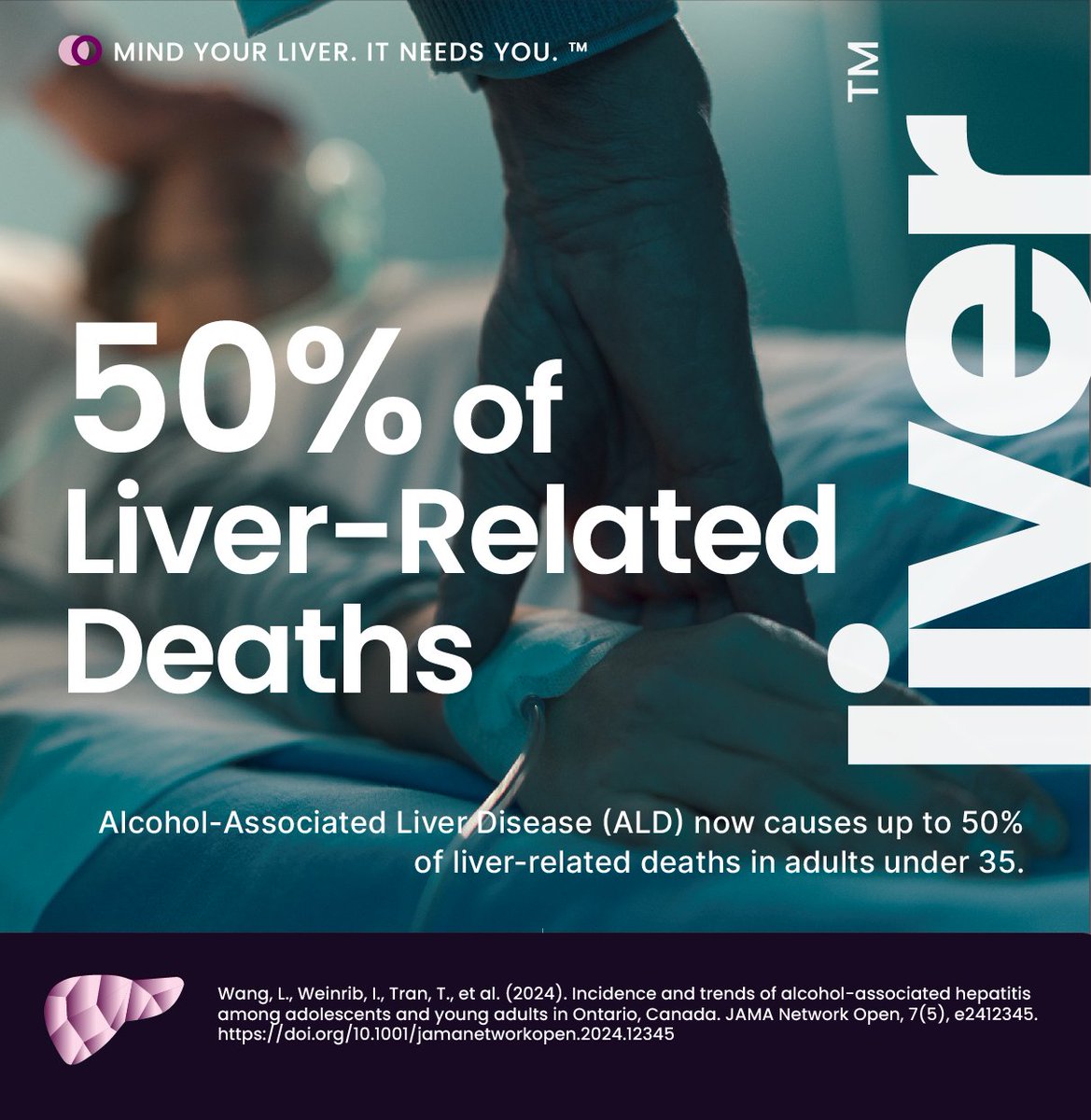 LiverAwareness's tweet image. 50% of liver-related deaths in young adults are from ALD. Most don’t even know what it is.
This isn’t just drinking. It’s a silent epidemic.
That's why we're here.
Mind Your Liver. It Needs You.™
#MindYourLiver #LiverAwareness #ALD #YoungAdultHealth
