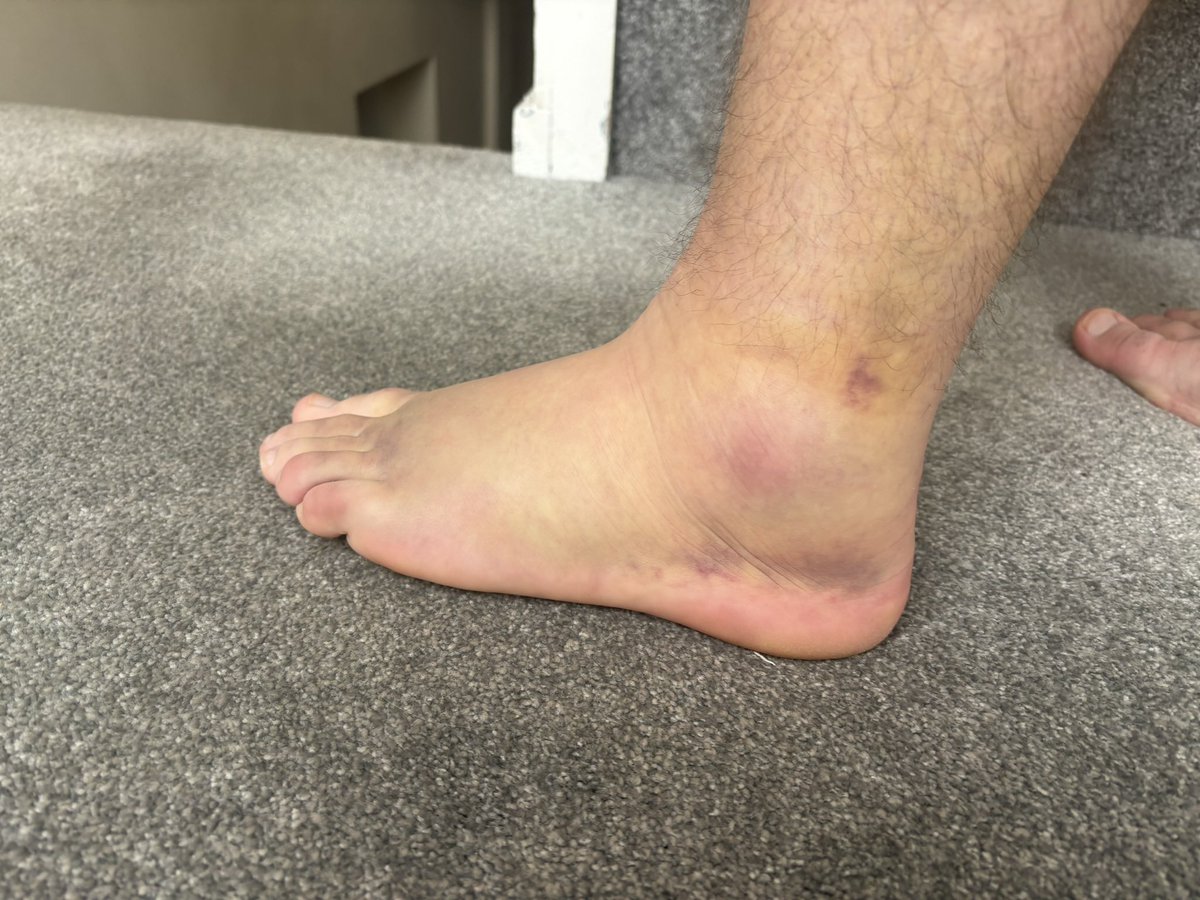 connorjacksn's tweet photo. @noahfinnadams the curse of the new rocks got you as well  😔😔 https://t.co/ZmLCkCyiAc