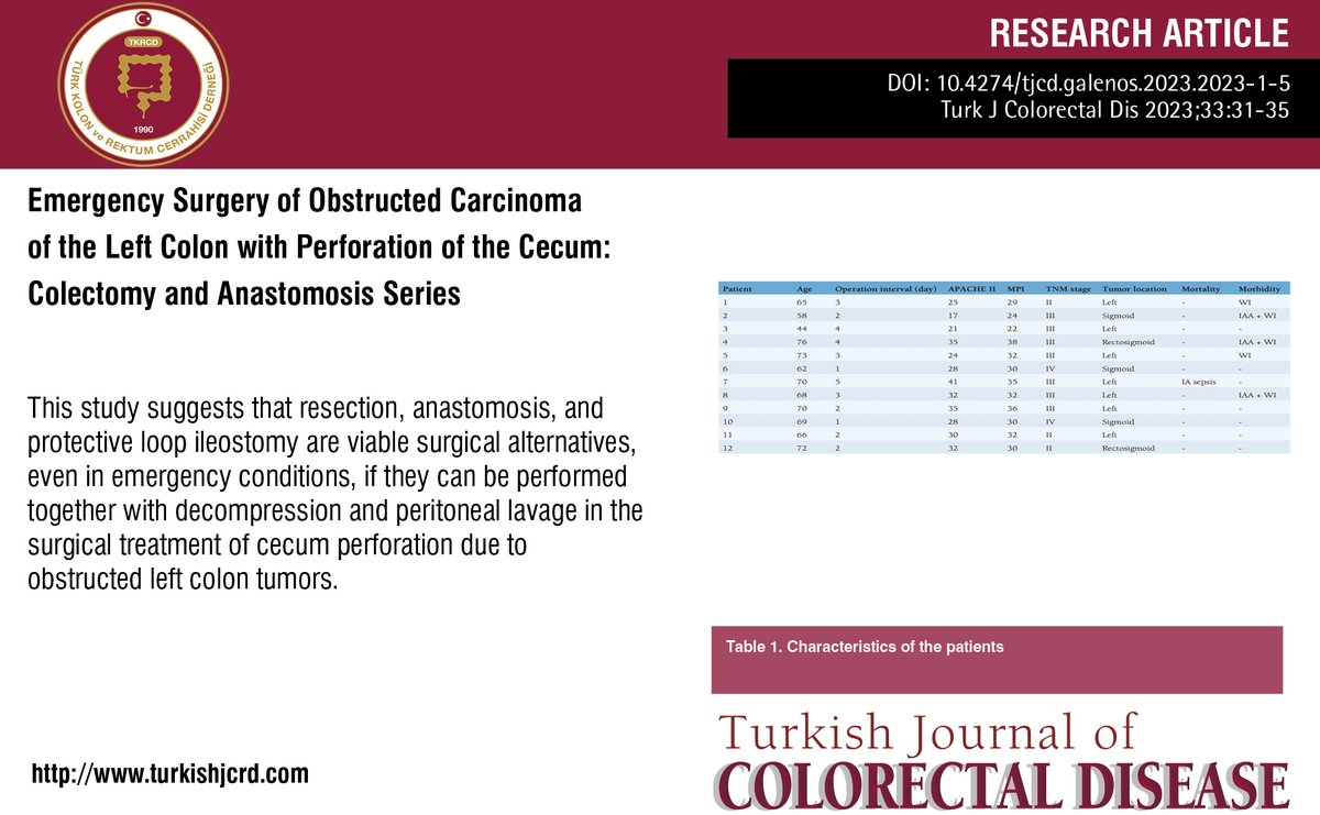 turkdiscolrect's tweet image. Emergency Surgery of Obstructed Carcinoma of the Left Colon with Perforation of the Cecum: Colectomy and Anastomosis Series
You can see the free full text of the research by Erkan Dalbaşı et al.
Link : turkishjcrd.com/articles/emerg…
#Cecum #perforation #colectomy #tumor #obstruction