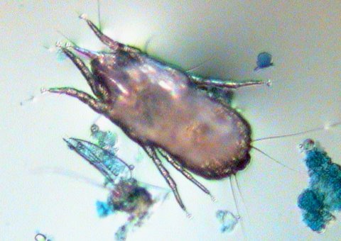 HouseDustMite (@nellnockles) on Twitter photo Ever wonder why house dust mites eat skin scales housedustmite.com/r/curious/why-… Ha, for the mite it's a plate full of food. <a href="/_BDNG/">British Dermatological Nursing Group</a> <a href="/KECKSchool_USC/">Keck School of Medicine of USC</a> <a href="/EAACI_JM/">EAACI JM</a> <a href="/eczemasupport/">Nottingham Eczema</a> <a href="/DrGuddiSingh/">DrGuddiSingh</a> Ever wonder why house dust mites eat skin scales housedustmite.com/r/curious/why-… Ha, for the mite it's a plate full of food. <a href="/_BDNG/">British Dermatological Nursing Group</a> <a href="/KECKSchool_USC/">Keck School of Medicine of USC</a> <a href="/EAACI_JM/">EAACI JM</a> <a href="/eczemasupport/">Nottingham Eczema</a> <a href="/DrGuddiSingh/">DrGuddiSingh</a>