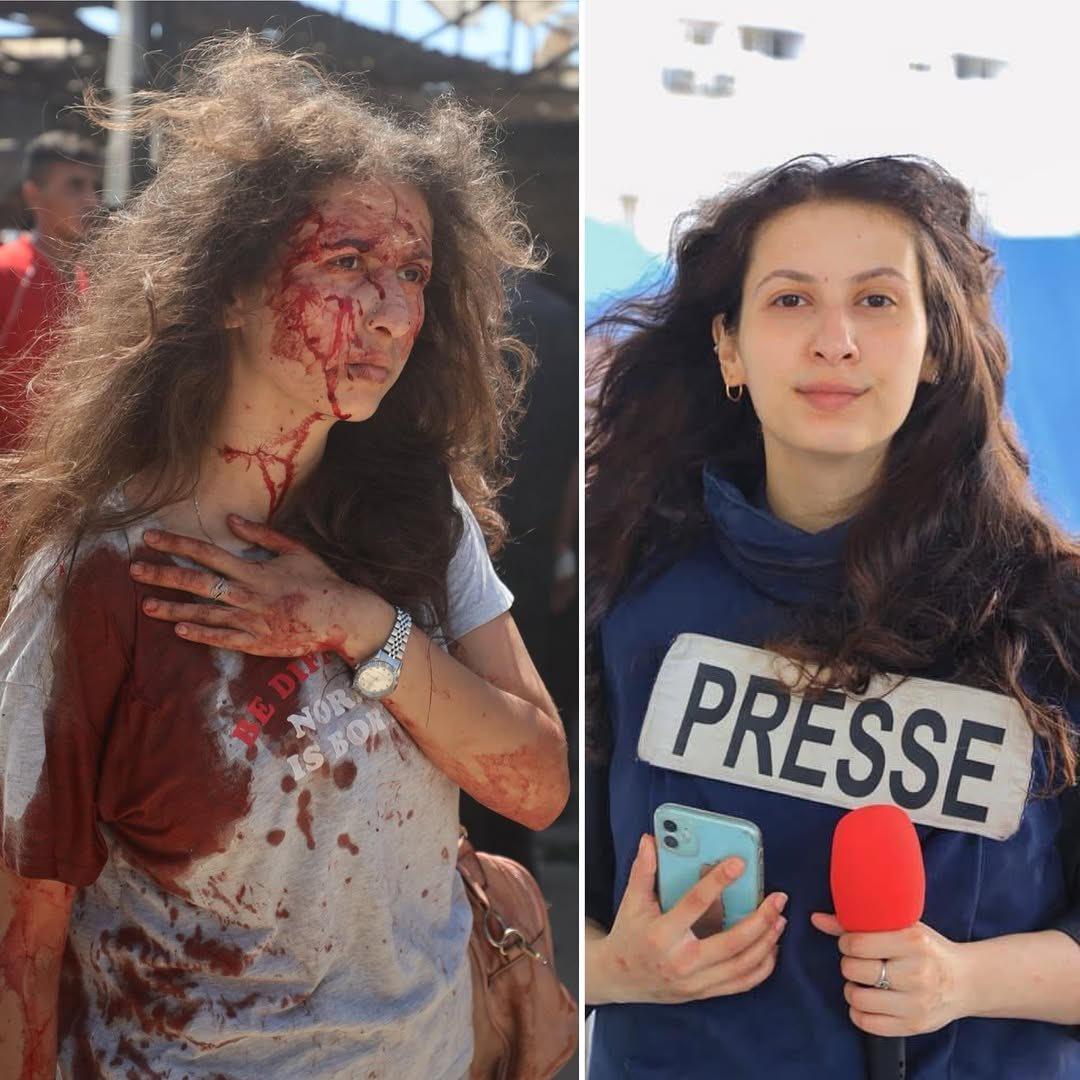 The Palestinian Journalist
Bayan Abusultan has been wounded after the Israeli occupation targeted Al-Baqa cafe on the Gaza City beach.