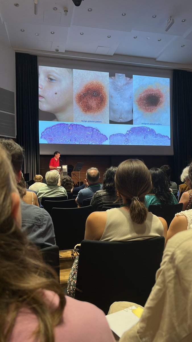 Gonzalo De Toro (@gonzadetoro) on Twitter photo #derrmpath Summer academy Graz 2025. Enjoy dermatopathology with <a href="/MarcelaSaebL/">Marcelasaeblima.</a> #Graz2025 #derrmpath Summer academy Graz 2025. Enjoy dermatopathology with <a href="/MarcelaSaebL/">Marcelasaeblima.</a> #Graz2025