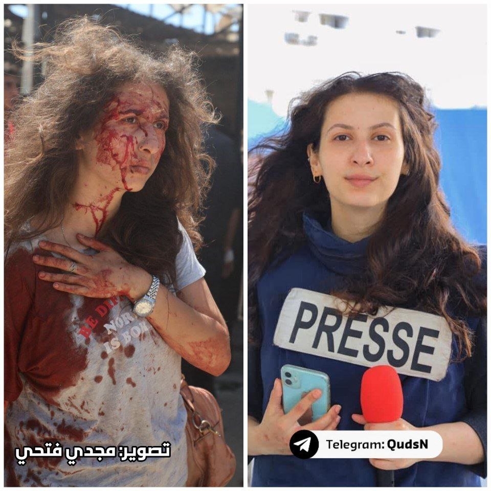 Journalist Bayan Abu Sultan was injured this afternoon in the horrific Israeli attack on the Al-Baqa Cafeteria on the Gaza City beach. At least 22 people were killed and many others wounded in the massacre, including some in critical condition.