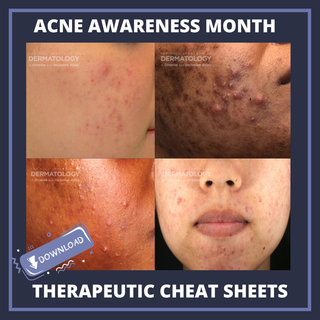 June is Acne Awareness Month. Stay updated on acne treatment options by downloading these Therapeutic Cheat Sheets today! ow.ly/Ai7M50Wim6c
#acneawarenessmonth #acnetreatment #dermatologyeducation #therapeuticcheatsheets #ODAC2026