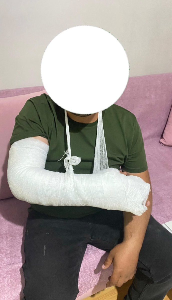 ikomder's tweet image. Yozgat Akdağmadeni K1 Ceza İnfaz Kurumunda görev yapan İnfaz ve Koruma Memuru Ö. A.&apos;ya iki tane eski mahkumun küfür, hakaret ve tehdit ettiği sonrasında saldırdığı; saldırı sonucunda meslektaşımız Ö.A.&apos;nin kolunun çatladığı ve vücudunda darbeye bağlı ezikler olduğunu öğrendik.…