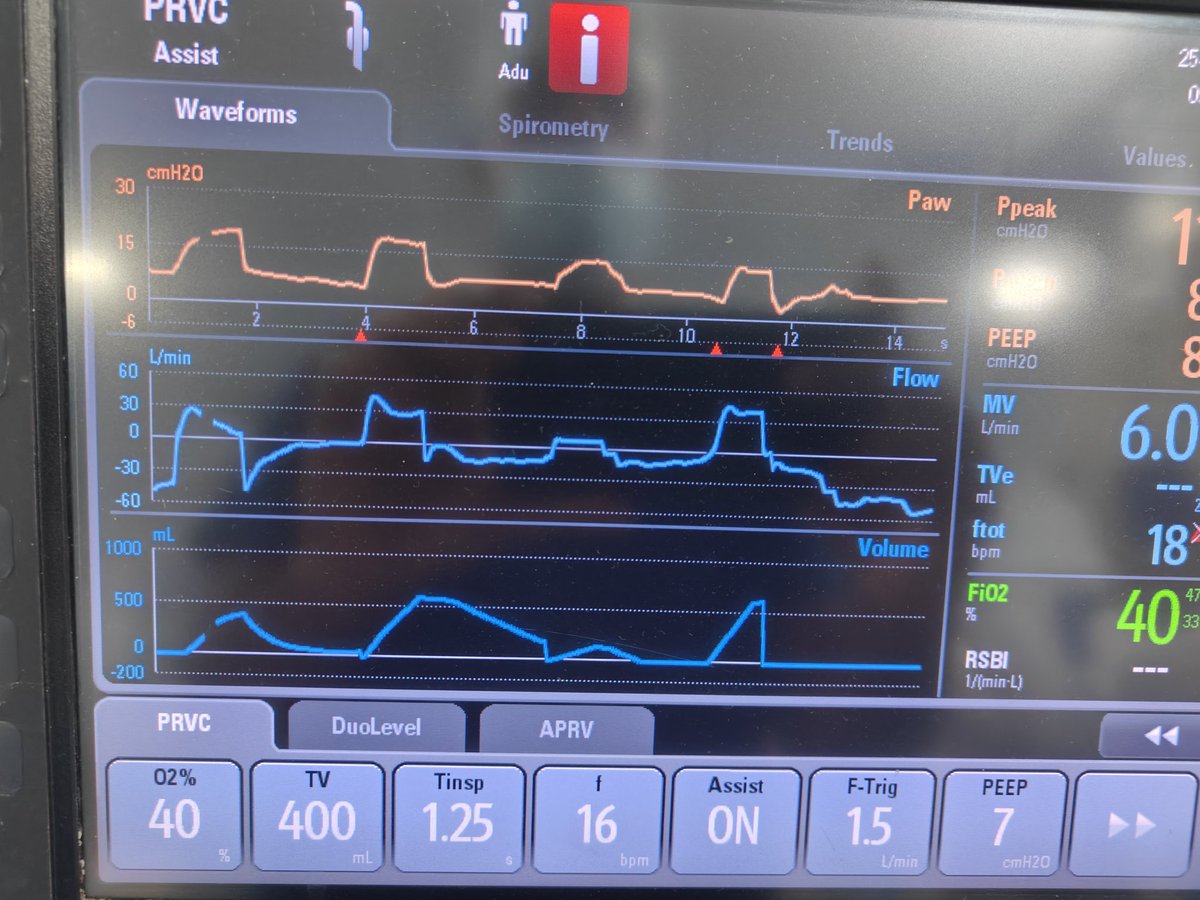 drvimalzenICU's tweet image. What&apos;s wrong with this Graphics