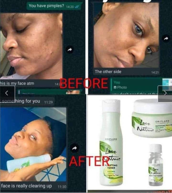 PerpetualPeace4's tweet image. Love Nature Skincare.
Helps hydrate.
Helps purify and soothe skin.
Helps skin feel cleansed,toned and refreshed.
Price:34,970.