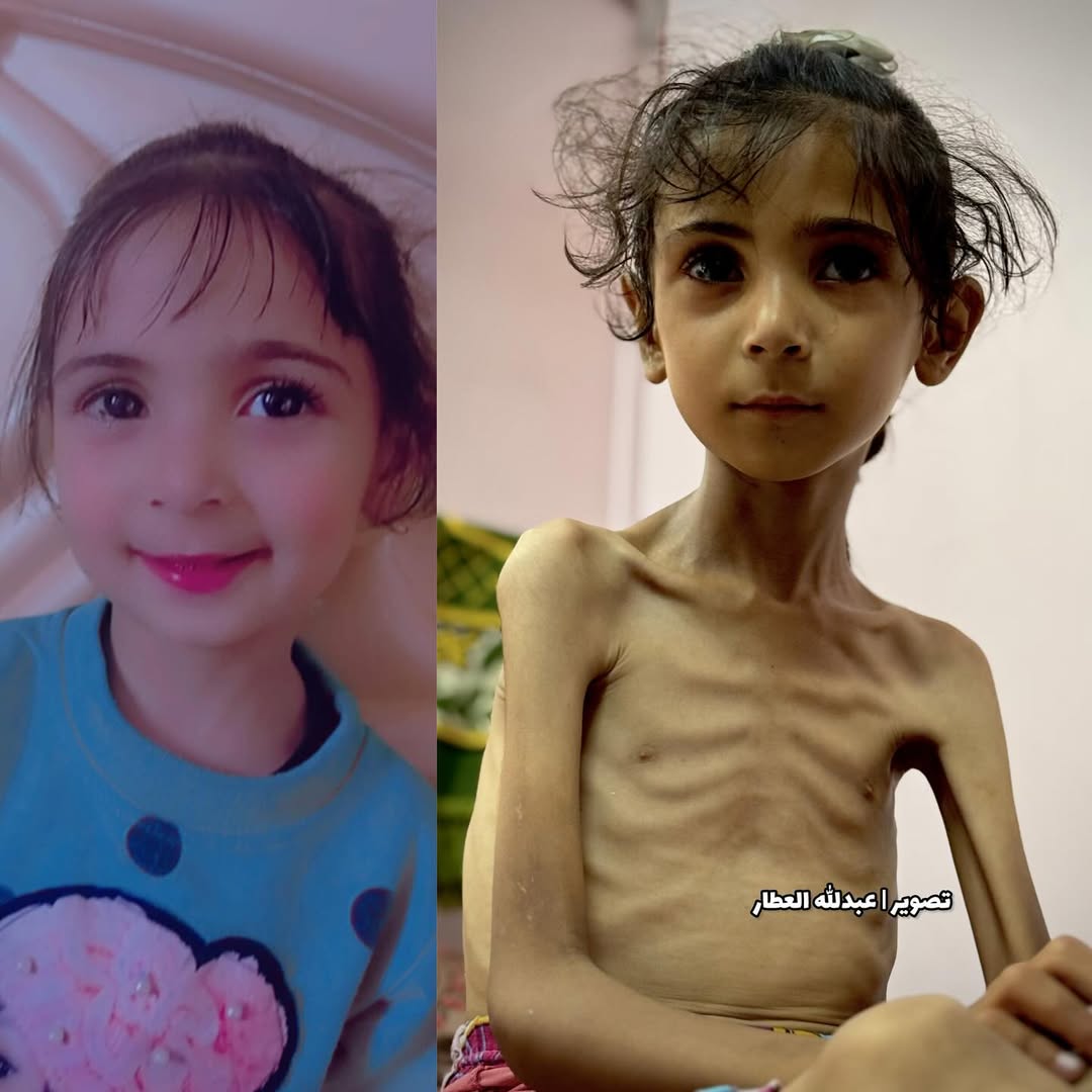 7 yaşındaki Gazzeli çocuk Amal El-Bayuk