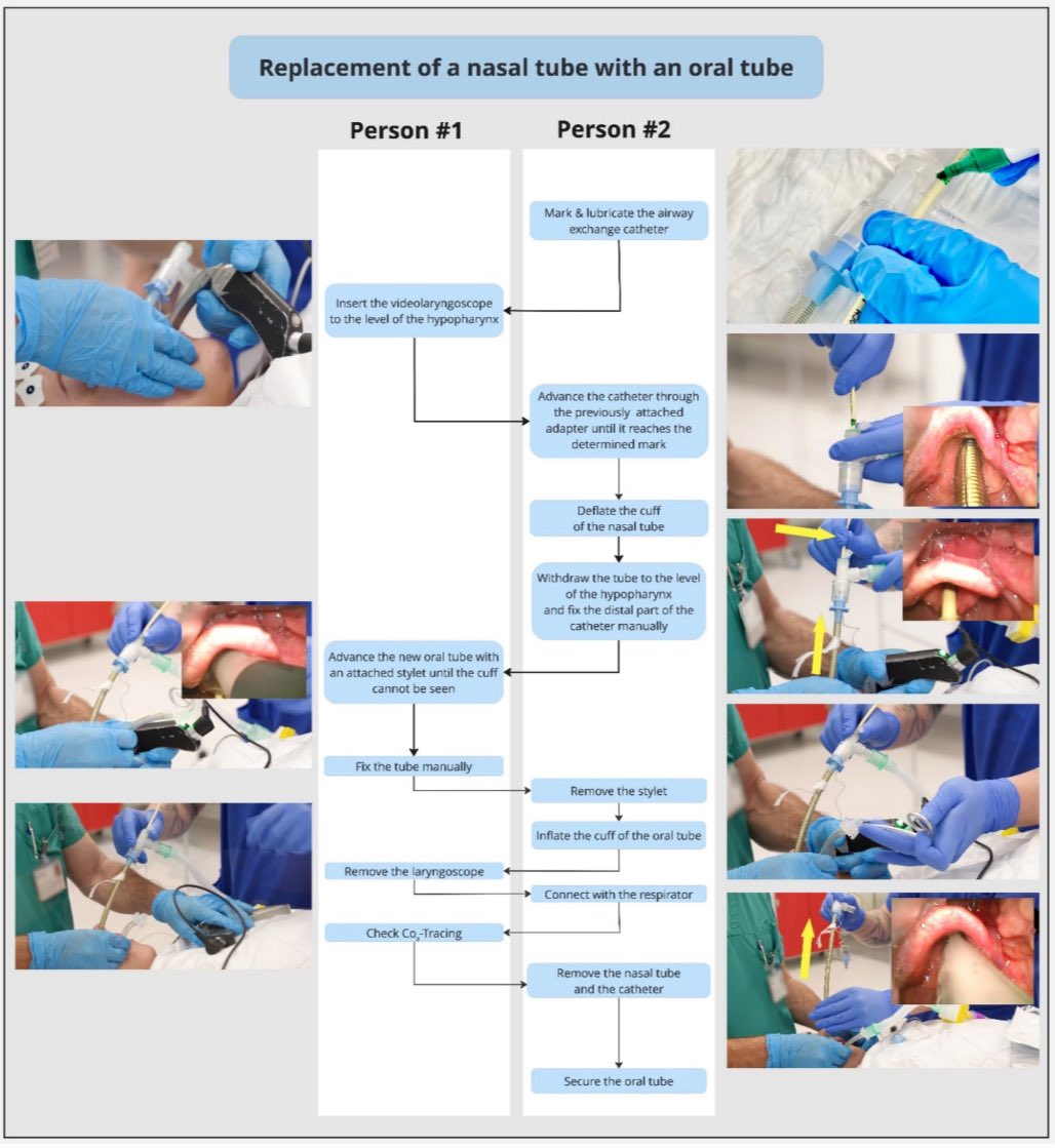 DAS Extubation Guidelines
