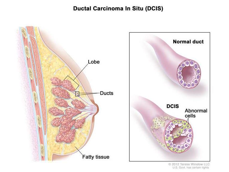 UMichChE's tweet image. New funding supports research that could prevent long-term breast cancer metastases.
ChE Prof. @NagrathSunitha has received funding from the @UMRogelCancer to lead innovative research using microfluidic assays and implantable scaffolds.
Read more: michiganche.info/4iX1gQ1