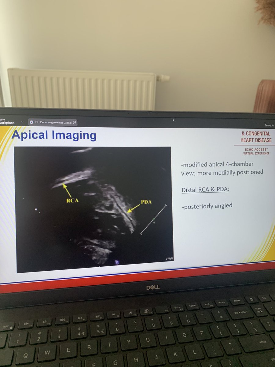 witkowskimed's tweet photo. Weekend with congenital heart defects #echo @ASE360 https://t.co/TOB1ajV1d3