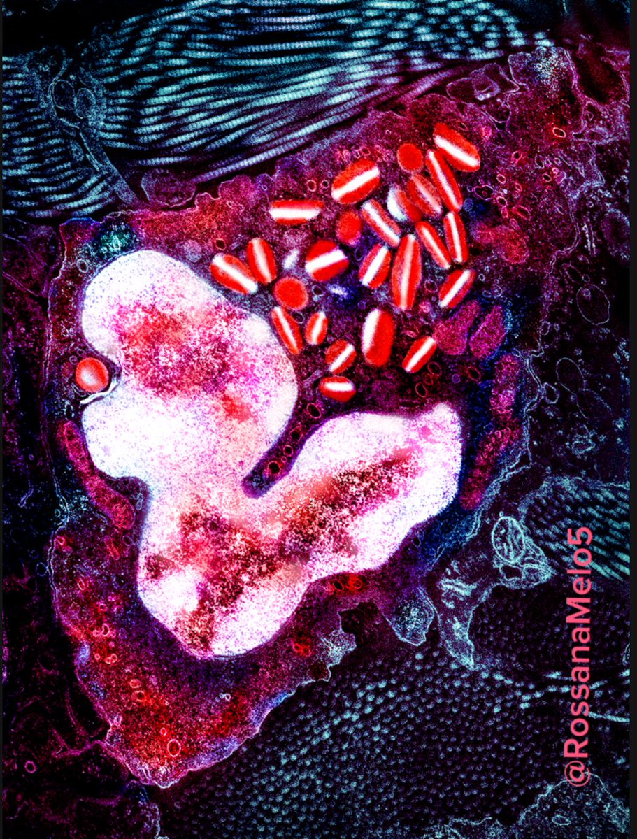 Rossana Melo (@rossanamelo5) on Twitter photo The power of red! An #eosinophil in the skin bridging #microscopy and #art - my new piece <a href="/EosinophilSoc/">International Eosinophil Society</a> Science & Art Exhibition in Montpellier (July, 7-11)!
#MicroscopyMonday #sciart #cellbiology The power of red! An #eosinophil in the skin bridging #microscopy and #art - my new piece <a href="/EosinophilSoc/">International Eosinophil Society</a> Science & Art Exhibition in Montpellier (July, 7-11)!
#MicroscopyMonday #sciart #cellbiology