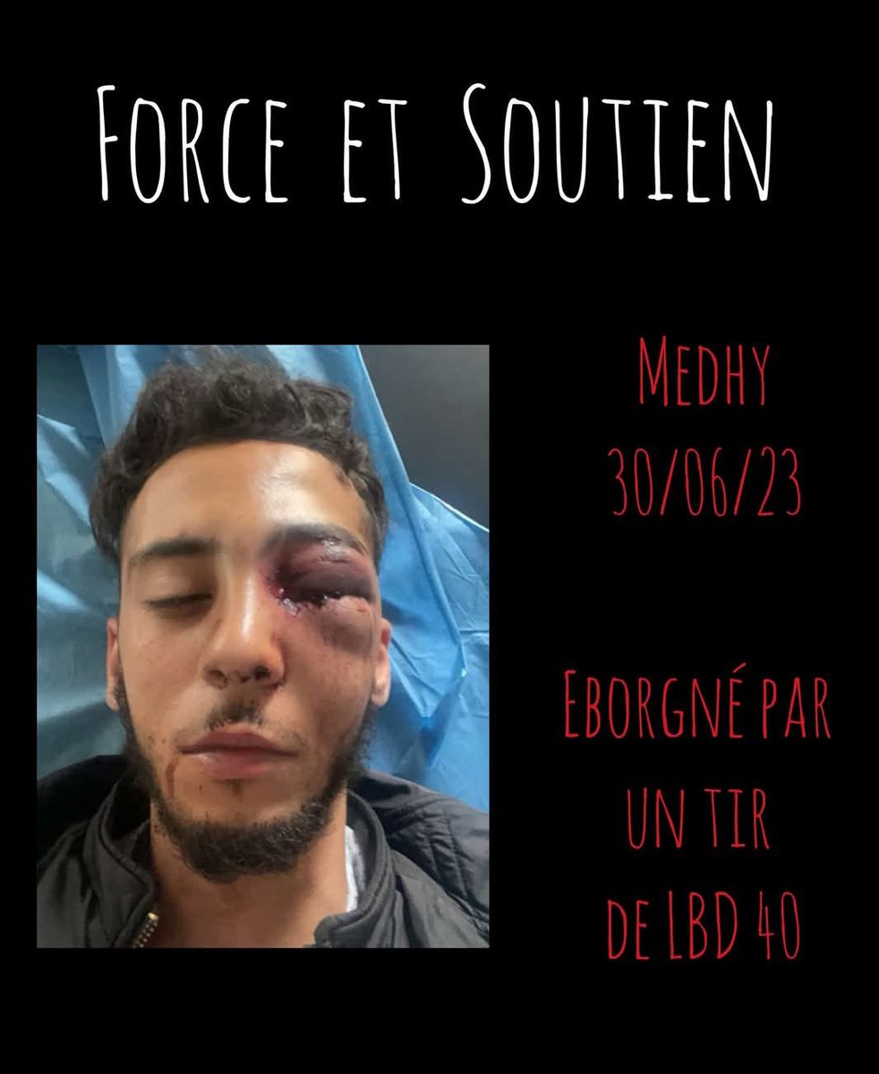 Deux ans aujourd'hui que medhy fut mutile
On n oubli pas on ne pardonne pas