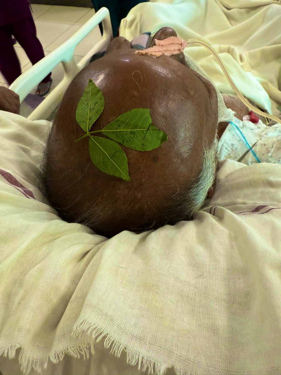 काशी में मरीजों के अंतिम विश्वास यही है। 

किसी भी चिकित्सक के भी अंतिम विश्वास यही है। 

अक्सर, ऐसे विश्वास हम चिकित्सकों को रोज़ आईसीयू में देखने को मिलते हैं।