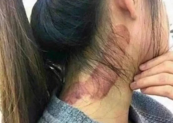 Moja córka została zaatakowana przez imigranta z Erytrei w parku podczas spaceru! Żona twierdzi, że nic się nie stało i Ci erytrejczycy to zapewne mili ludzie! Szaleństwo totalne