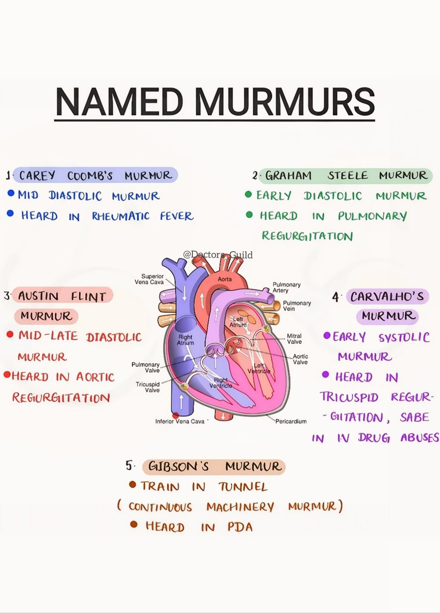 Heart named MURMURS summarized
