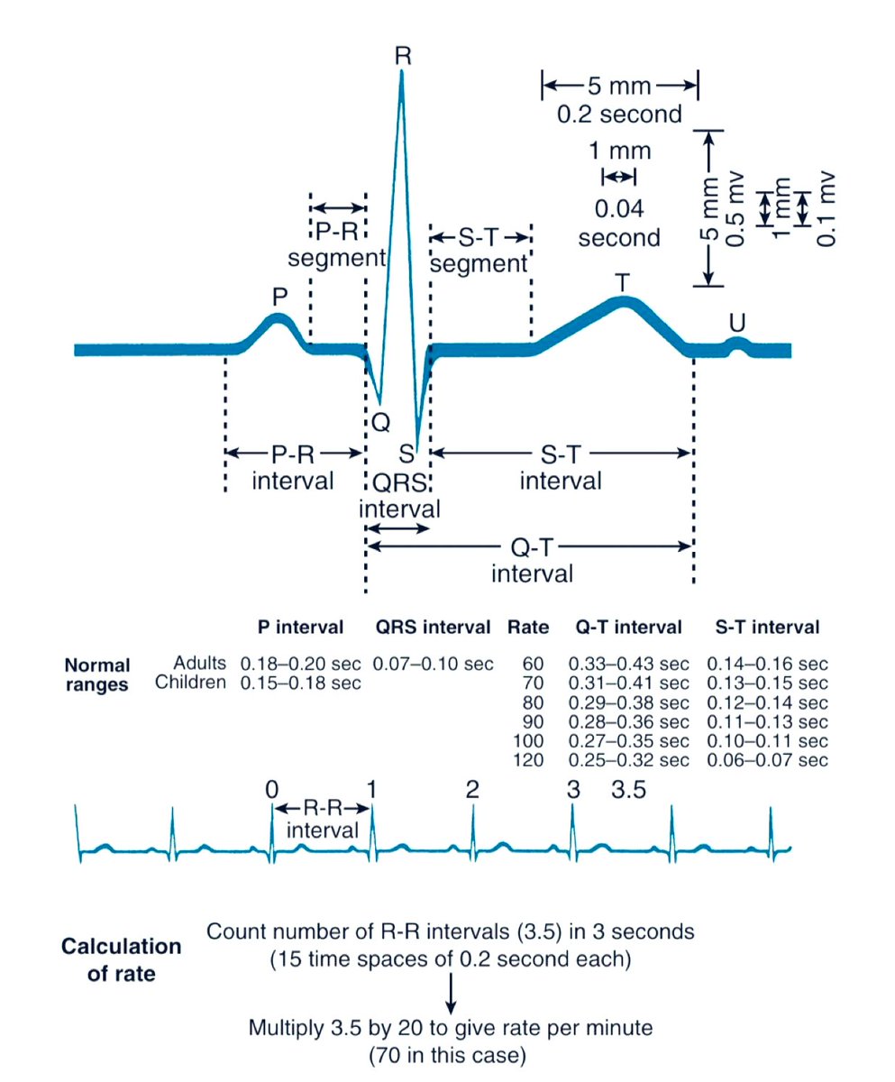 Components of the ECG demonstrating normal intervals