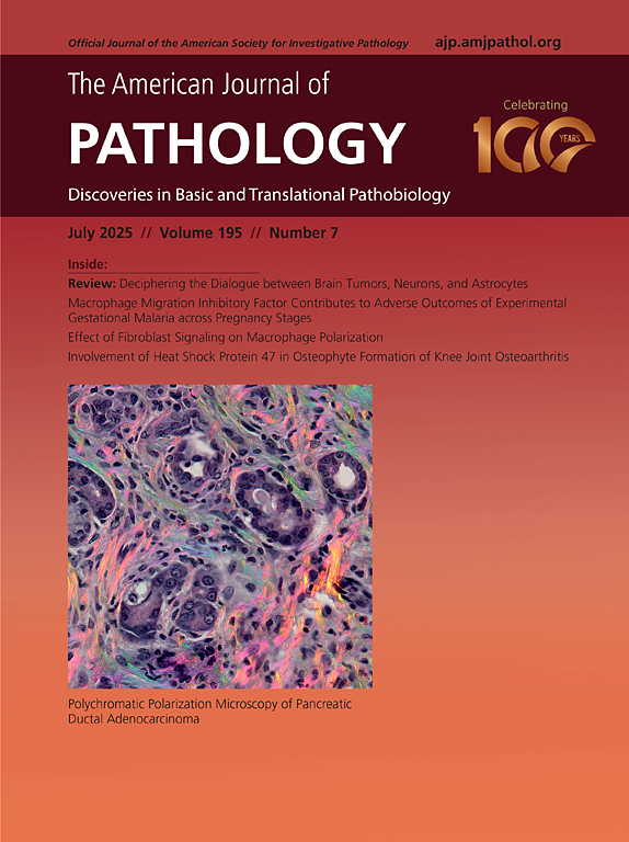 Paolo Provenzano (@ppproven) on Twitter photo Want to get direct quantitative ECM orientation data in histology slides in an easy straightforward way? Check out our new paper on PPM. <a href="/theNCI/">National Cancer Institute</a> <a href="/UWMadisonLOCI/">UW LOCI (Eliceiri lab)</a> <a href="/AmericanCancer/">American Cancer Society</a>
sciencedirect.com/science/articl… Want to get direct quantitative ECM orientation data in histology slides in an easy straightforward way? Check out our new paper on PPM. <a href="/theNCI/">National Cancer Institute</a> <a href="/UWMadisonLOCI/">UW LOCI (Eliceiri lab)</a> <a href="/AmericanCancer/">American Cancer Society</a>
sciencedirect.com/science/articl…