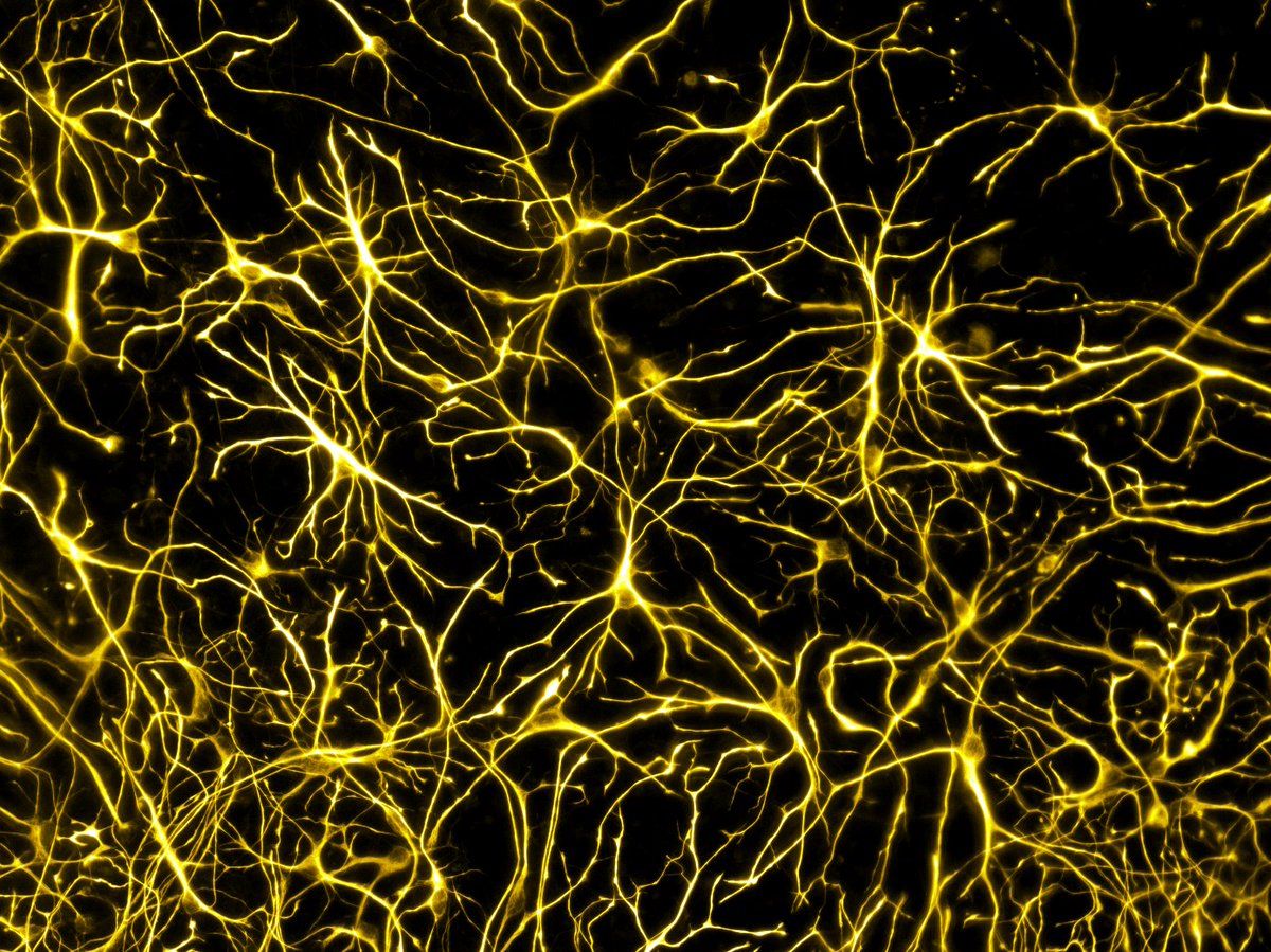 Sloan_Lab's tweet image. New lab preprint! Head over to 🦋 for the full thread!!

biorxiv.org/content/10.110…